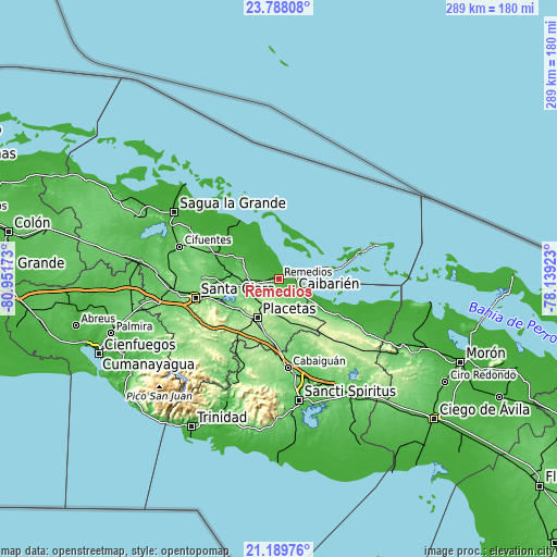 Topographic map of Remedios